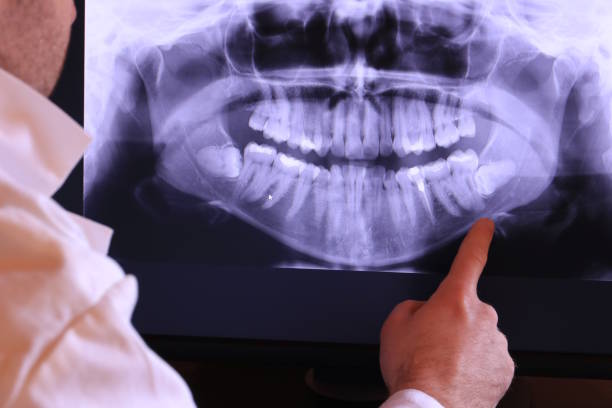 Best Emergency Tooth Extraction in Yosemite Valley, CA
