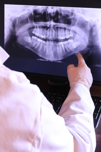 Best Emergency Wisdom Teeth Removal in Yosemite Valley, CA